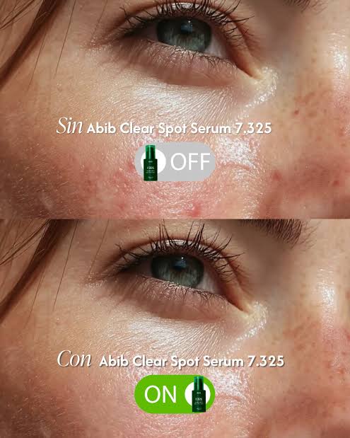 Abib Clear Spot Serum 7.325 Pump 30 ml - Bild 3